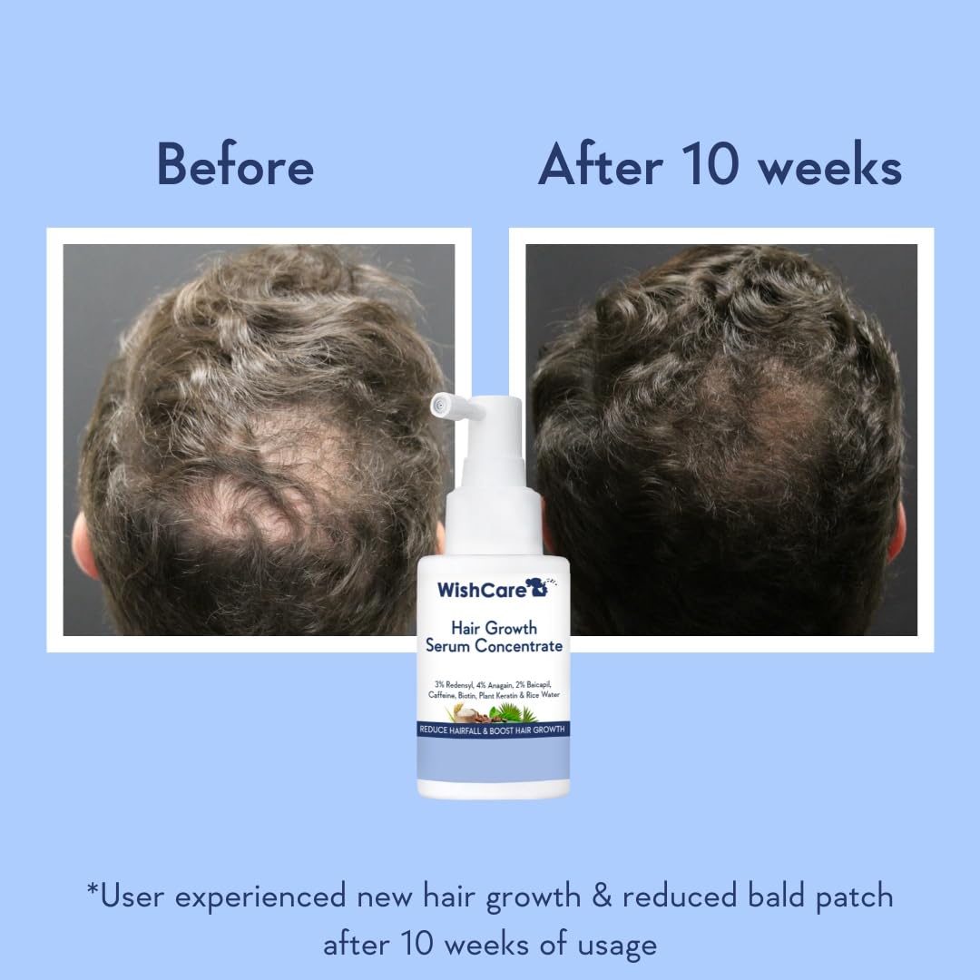 WishCare Hair Growth Serum Concentrate - 3% Redensyl, 4% Anagain, 2% Baicapil, Caffeine, Biotin & Rice Water - Advanced Hair Growth Serum for Hair Fall Control & Hair Growth 30ml2